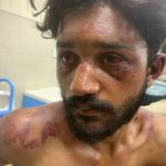 Adolescente cristiano golpeado por proteger a mujeres en Pakistán
